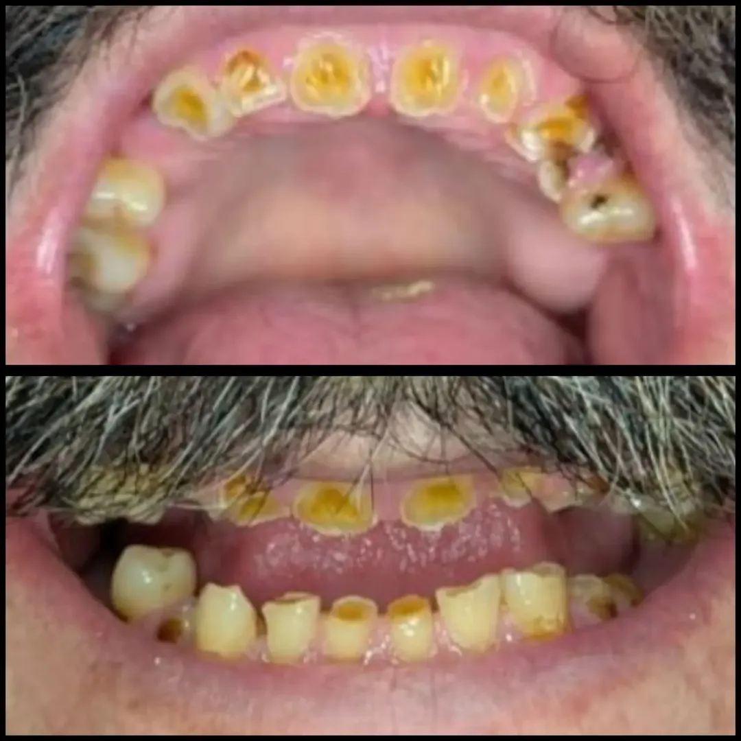 Caso 17 - imagem 2